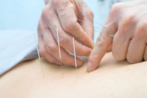 Family Chiropractic with Acupuncture, The Family Chiropractic Center of Bayonne